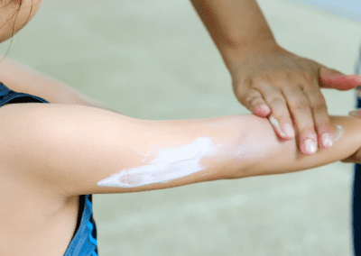 Tips to Keep Kids Stay Safe in the Sun: From Sunscreen to Water Safety